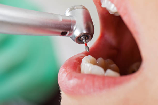 Best Cracked Tooth Emergency Dentist  in Sterling, AK
